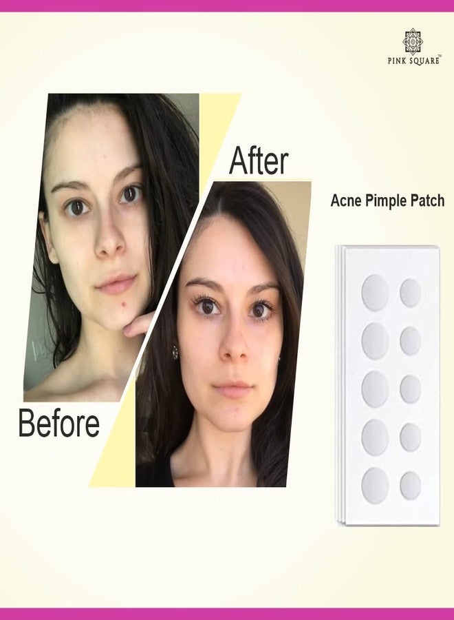 Pink Square Acne Pimple Patch|24 Invisible Waterproof 2% Salicylic Acid & Hydrocolloid Spot Acne Pack of 72 Patches for Men & Women|Reduces pus overnight|Heal acne scars - Image 4