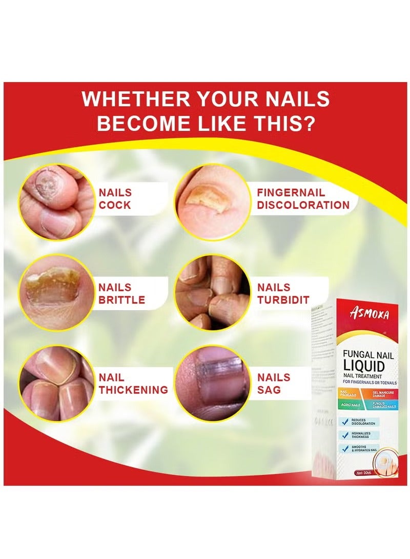 أسموكسا علاج فطريات الأظافر السائل لعلاج فطريات الأظافر لأظافر القدمين واليدين تجديد فطريات الأظافر مضاد للفطريات إصلاح الأظافر ينعم ويرطب الأظافر يقلل من تغير اللون 30 مل - Image 4