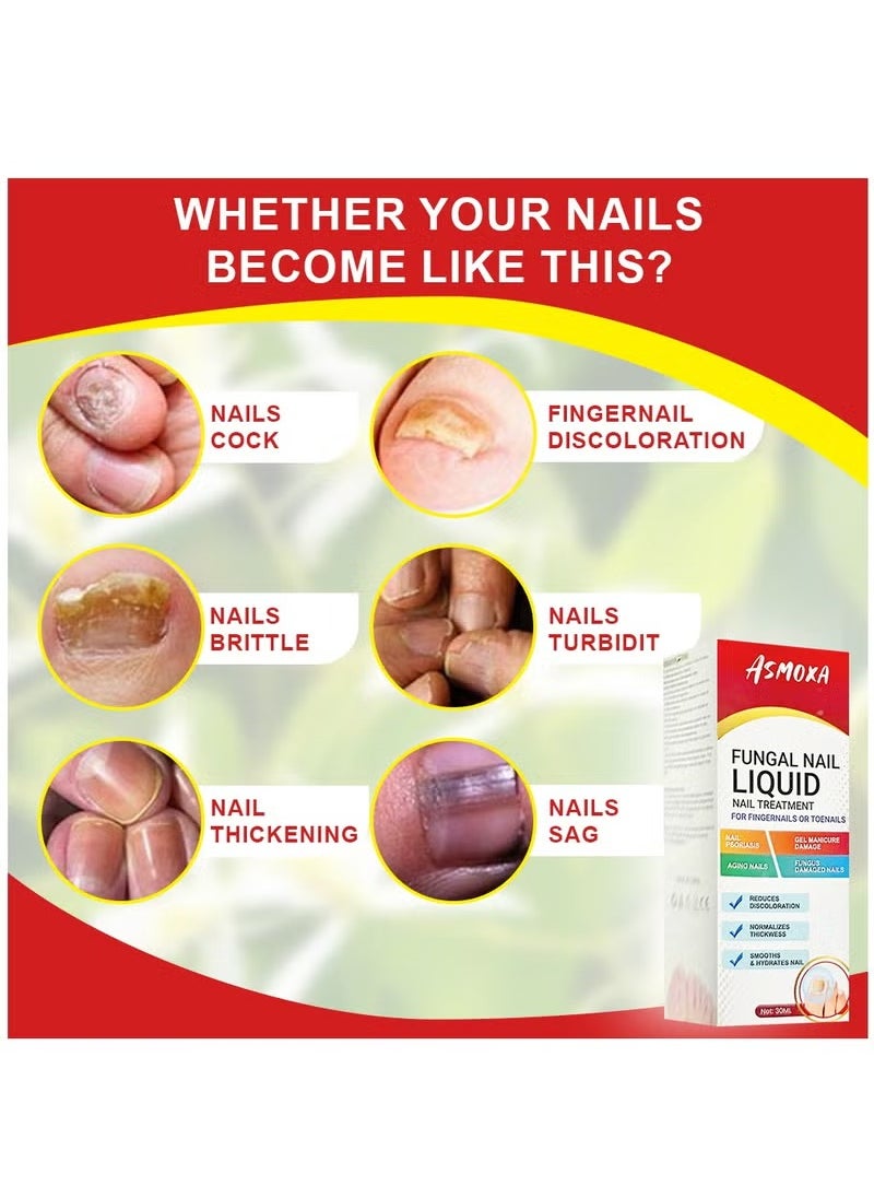 ASMOXA Fungal Nail Treatment Liquid Nail Fungus Treatment for Toenails & Fingernails Fungal Nail Renewal Anti Fungus Nail Repair Smooth & Hydrates Nail Reduce Discoloration 30ml  - Image 5