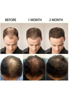 PURC Hair Growth Essence Oil For Hair Fall Hair Regrowth & Scalp Treatment Ginger Essential Oil Supports Healthy Hair Thinning Treatment Hair Growth Oil for Women & Men 20ml  - Image 4