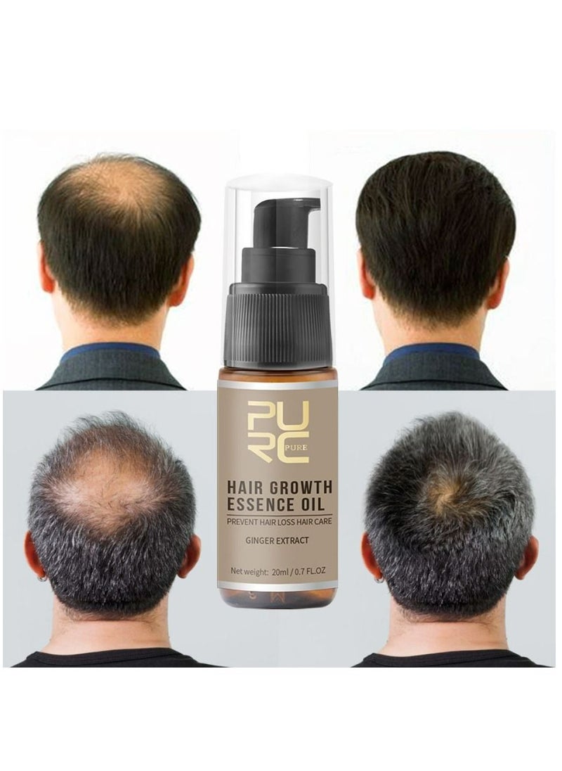 PURC - Hair Growth Essence Oil For Hair Fall Hair Regrowth & Scalp Treatment Ginger Essential Oil Supports Healthy Hair Thinning Treatment Hair Growth Oil for Women & Men 20ml - Image 1