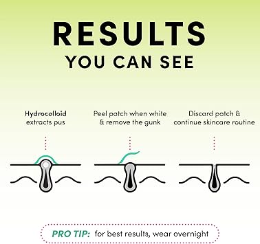Dots for Spots Dots for Spots Pimple Patches Pack of 24 Translucent Hydrocolloid Spot Treatment Stickers for Face FastActing Vegan Cruelty Free Korean Skin Care  - Image 2