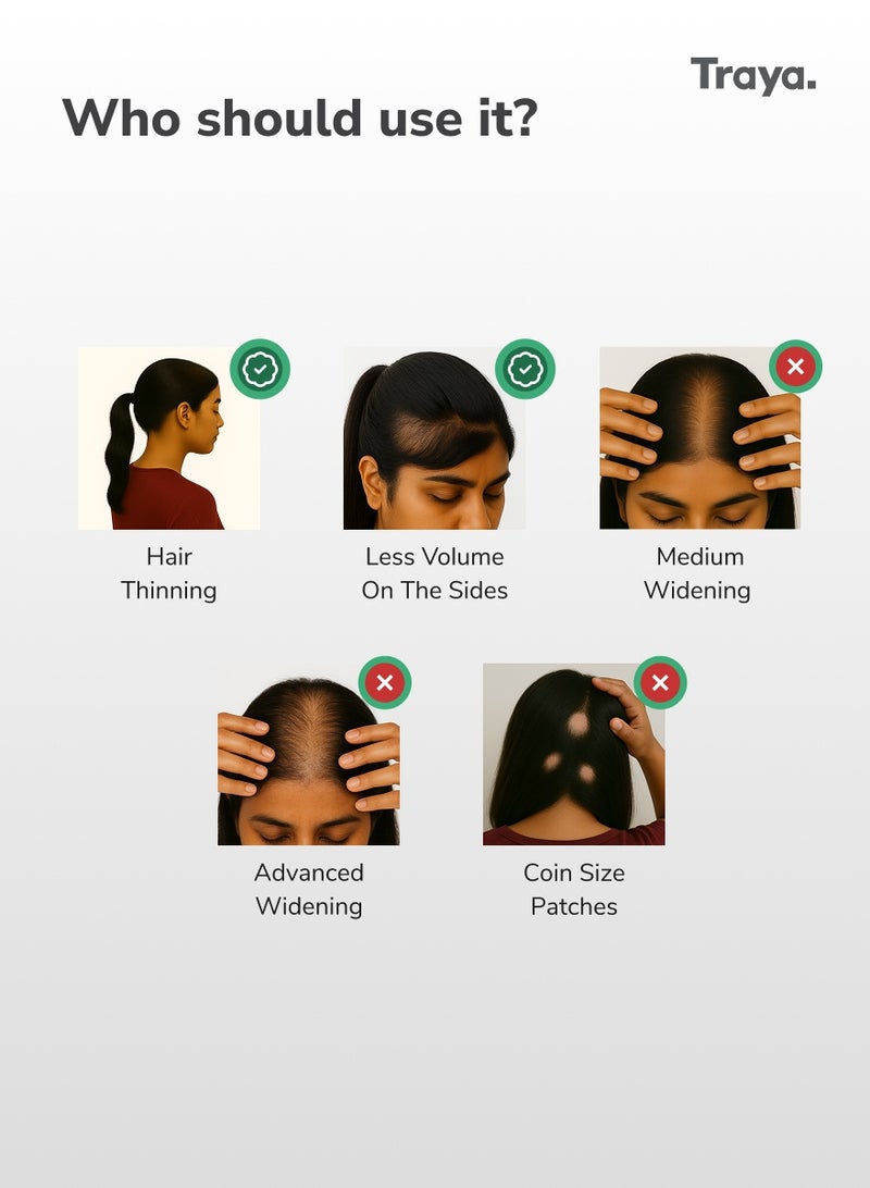 Traya Hair Regrowth Starter Combo Kit for Women | Limited Widening and Hair Loss | Combo of 4 Products - Image 2