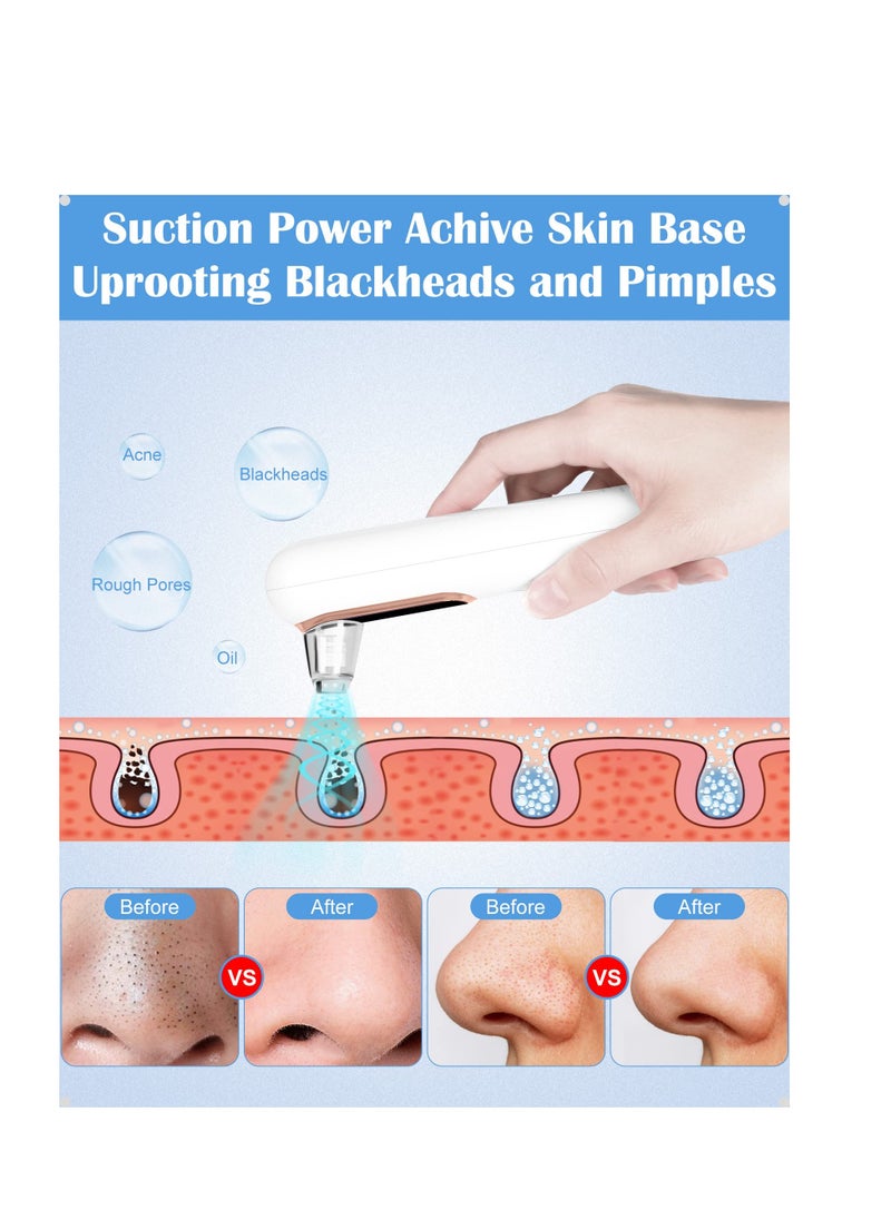 SYOSI Blackhead Remover Vacuum,Gentle and Effective Pore Cleanser spot pimple,Rechargeable Blackhead Sucker,Acne Comedone and Whitehead Extractor Tool,Upgraded Electric Facial Cleansing Beauty Tool  - Image 4