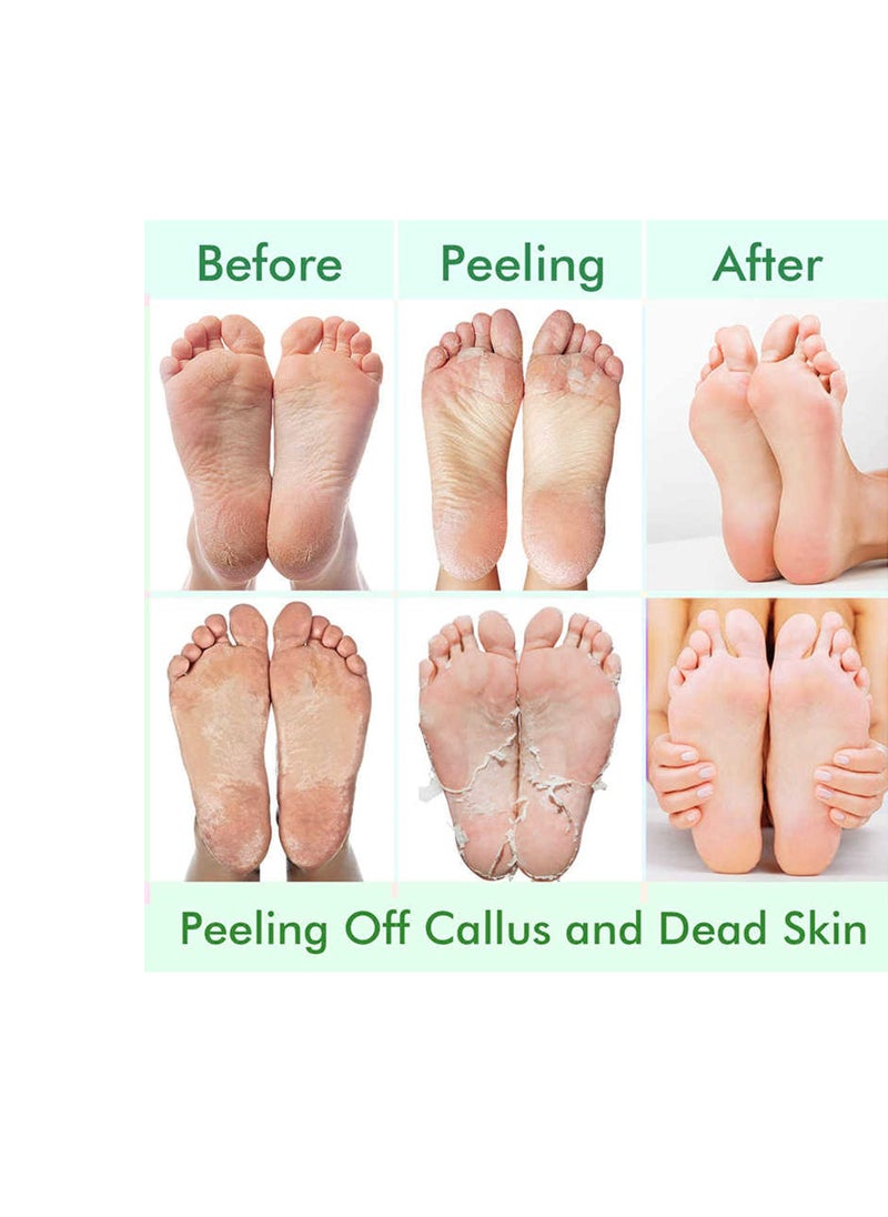 CMWGKBC - 5 Pack Foot Peel Mask,Exfoliator Peel Off Calluses Dead Skin Callus Remover,Foot Mask for Dry Cracked Feet,Foot Peel Mask with Lavender and Aloe Vera Gel for Men and Women Feet Peeling Mask - Image 1