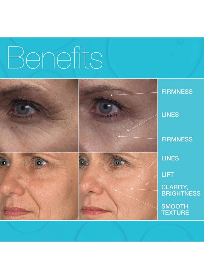 MD Complete by Dr. Brian Zelickson Md Complete Eye Wrinkle Duo | Professional Dermatologist Skin Rejuvenation | Includes Wrinkle & Radiance Remedy Plus With Retinol And Total Eye Treatment With Hyaluronic Acid And Peptides | Set Of Two - Image 2