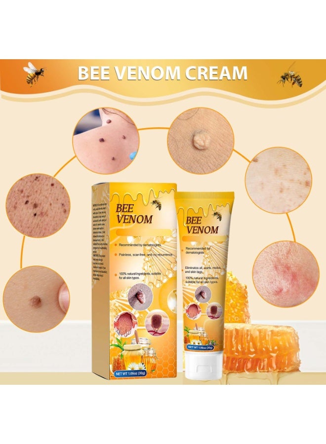 SYOSI Cream for Skin Repair, Professional  Treatment for Neck, Waist, Back, Hands & Feet, Men & Women Skin Care (2 Pack) - Image 4