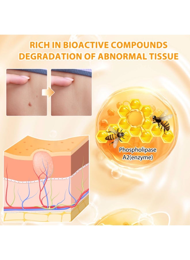 SYOSI Cream for Skin Repair, Professional  Treatment for Neck, Waist, Back, Hands & Feet, Men & Women Skin Care (2 Pack) - Image 2