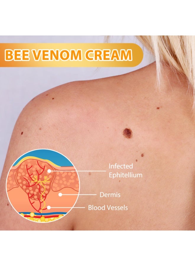 SYOSI Cream for Skin Repair, Professional  Treatment for Neck, Waist, Back, Hands & Feet, Men & Women Skin Care (2 Pack) - Image 3