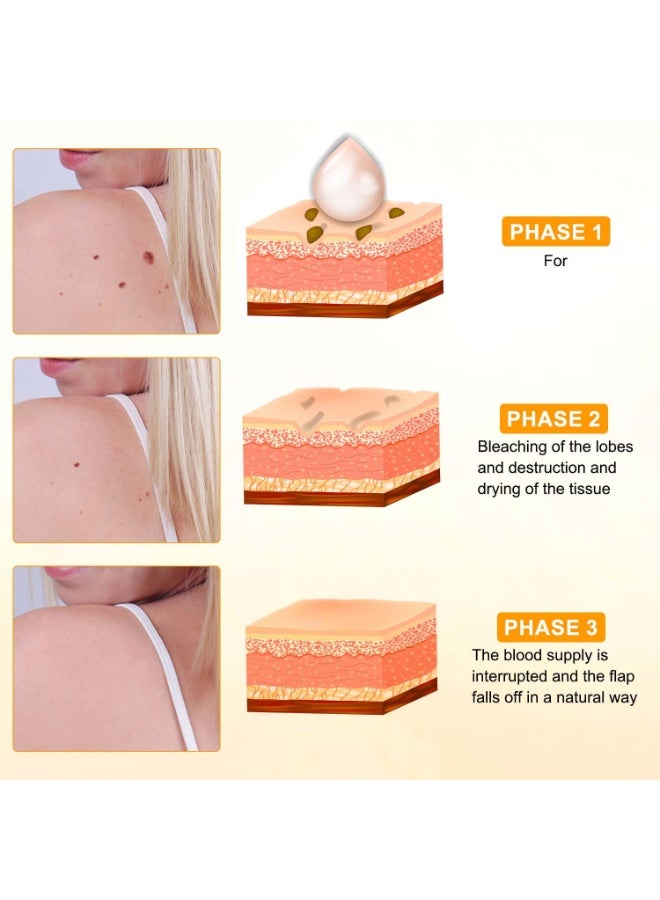 SYOSI Cream for Skin Repair, Professional  Treatment for Neck, Waist, Back, Hands & Feet, Men & Women Skin Care (2 Pack) - Image 5