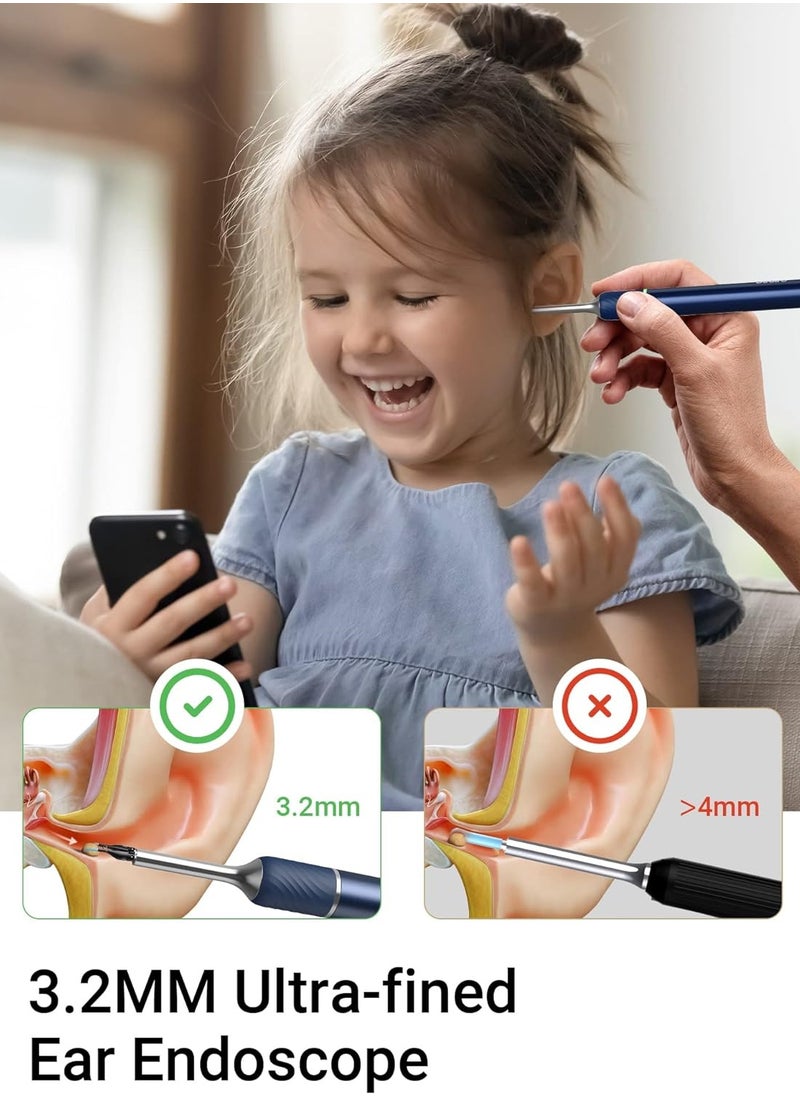 Note 5 Ear Wax Removal Tool with Ear Camera Ear Cleaner with Ear Pick and Tweezers Mode,1000W Ear Scope Universal Gyroscope for Earwax Removal