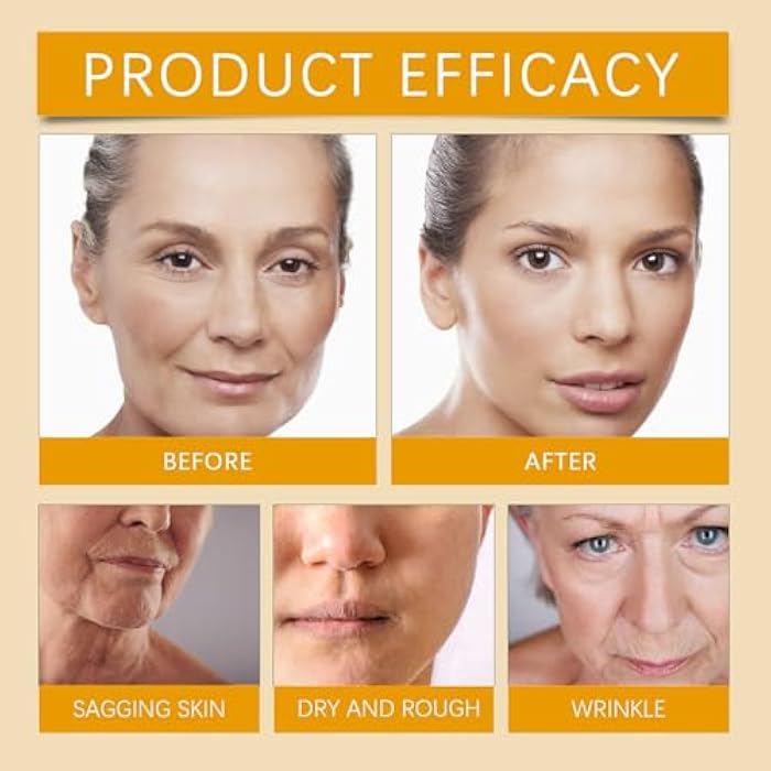 FYEBOO Bee Venom Moisturiser Cream Wrinkle Removal & Firming, Anti-Aging Eye & Face Bee Venom Skin Treatment Cream (2 Packs, 0.71Oz) - Image 5