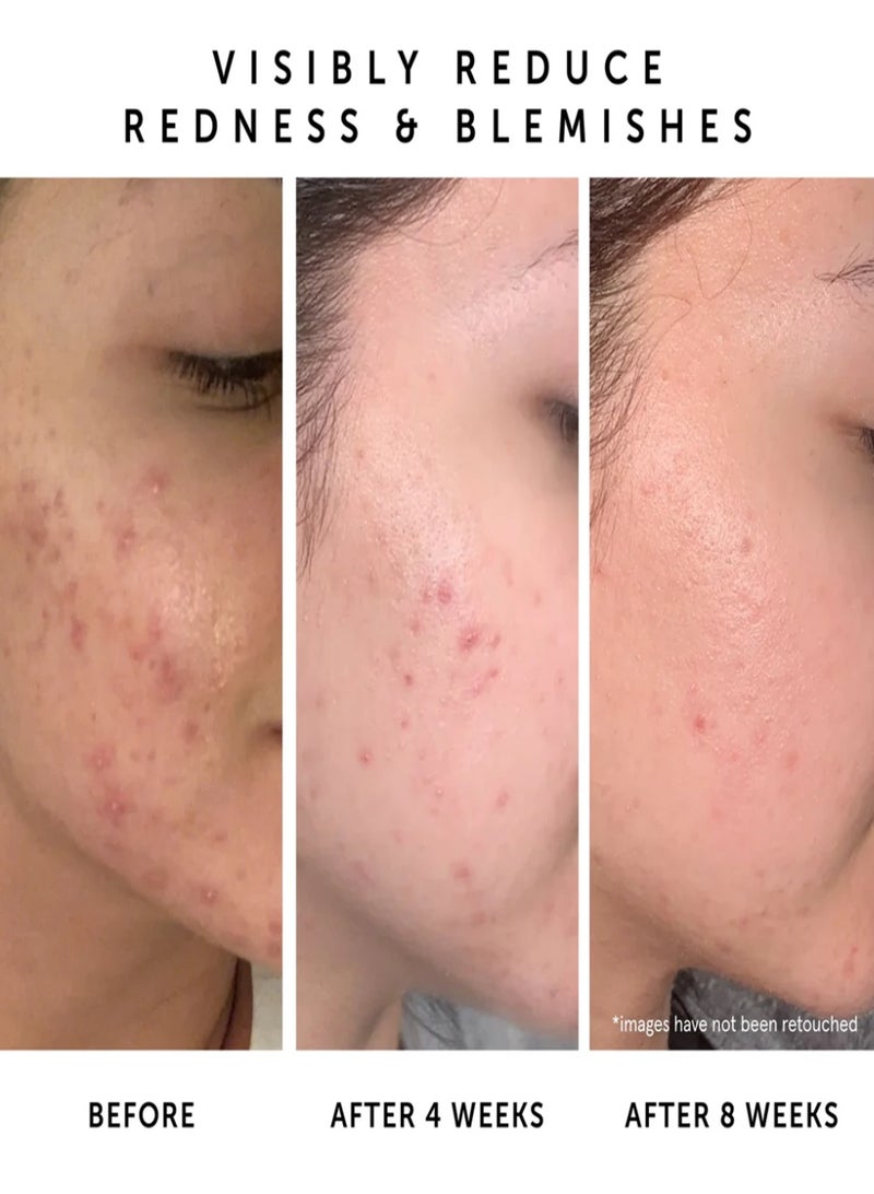 Herbivore Botanicals Lapis Blue Facial Oil for Balanced Skin - Image 2