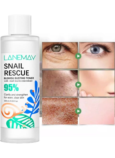 Snail Rescue Blemish Busting Toner | 95% Snail Mucus | Pore Cleanser | Moisturising and Balancing | CICA | Hyaluronic Acid | Non-comedogenic | Non-irritating| 100ml