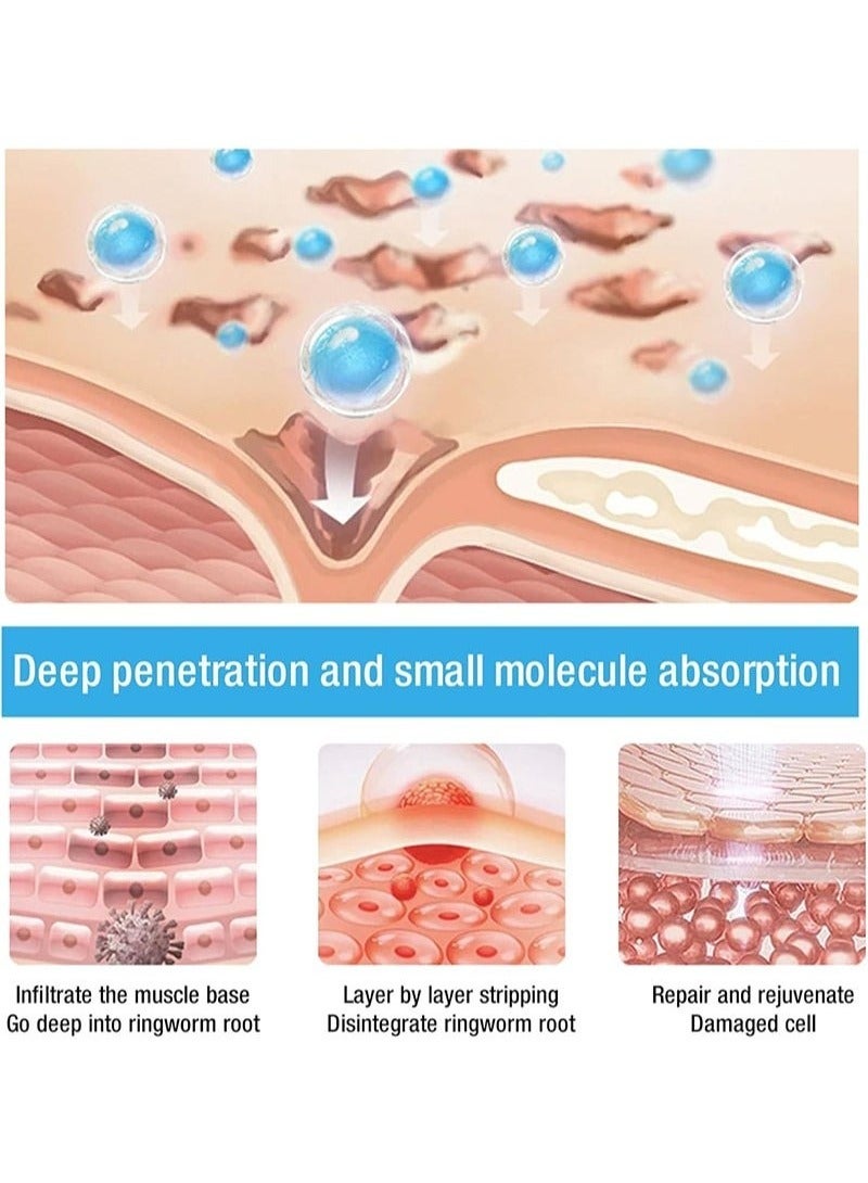 HEALMUSZ Maximum Strength Psoriasis Relief Cream – 4% Salicylic Acid, Fast-Acting Seborrheic Dermatitis & Anti-Itch Treatment for Redness, Flaking, & Scaling (3.4 oz) - Image 2