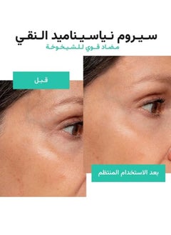 الموند بيوتي سيروم لازاله الحبوب والرؤس السوداء يحتوي على 5%زنك و1% PCA ونياسينا ميد  - Image 4