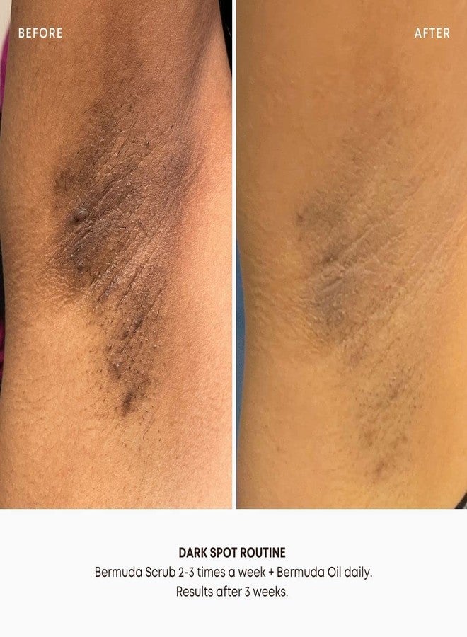 Bushbalm Dark Spots and Ingrown Hair 2 Step Routine - Rejuvenate and Nourish - Ingrown Hair Oil (30 ml) and Exfoliating Scrub (236 ml) - Bermuda - Valued at $49 - Image 5
