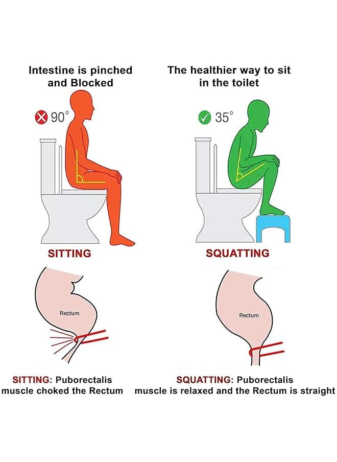 إيروريكس مقعد حمام Squatty Potty من Home Station باللون الأبيض مقاس واحد  - Image 5