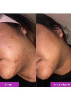 GOOD MOLECULES Good Molecules Discoloration Correcting Serum - Tranexamic Acid Ester Salt and Niacinamide for Dark Spots, Sun Damage, and Age Spots - Skincare Face  - Image 4