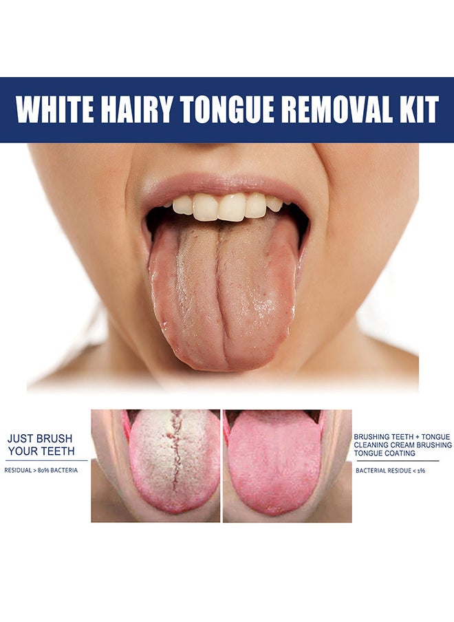 Jaysuing White Hairy Tongue Removal Kit, Tongue Cleaning Gel Set, Tongue Cleaner Gel with Soft Tongue Brush, Easy to Use Tongue Scraper Precise Cleaning Brush Kit, Keep Fresh Breath 50G  - Image 4