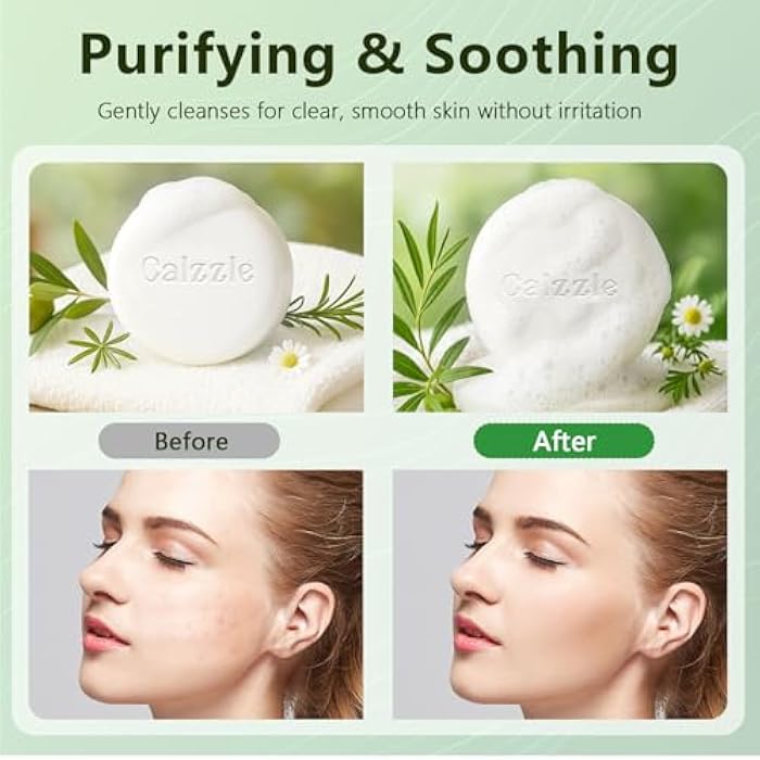 Calzzle 4 Pcs Herbal Soap Bar with Tea Tree Oil, Olive Oil & Organic Shea Butter - Natural Handmade Soap for Women & Men, Gentle Face, Body & Foot Cleanser for Dry, Itchy or Sensitive Skin, 3.53 oz - Image 4
