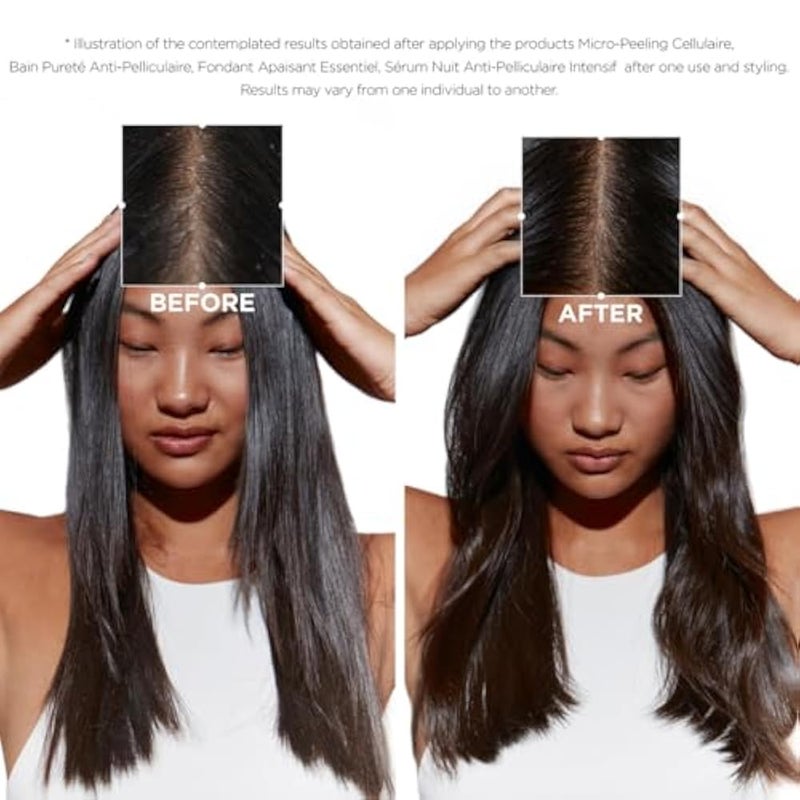 Kérastase Symbiose Purifying Anti-Dandruff Shampoo For Oily Sensitive Scalp Prone To Dandruff - 250ml - Image 3
