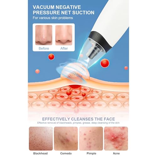 SKYLIGHT Blackhead Remover Vacuum Electric Pore Cleaner for Whitehead Removal Tool, Acne Deep Face Machine, USB Rechargeable Derma Adjustable Suction & Interchangeable Heads Facial Device Men Women - Image 5