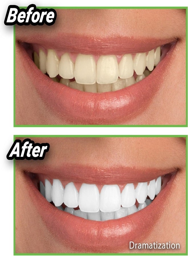 Miracle Teeth Whitener | Natural Whitening Coconut Charcoal Powder | Gentle on Teeth and Gums and Removes Stains Caused by Smoking, Coffee, Soda, Red Wine and More! – As Seen on TV - Image 3