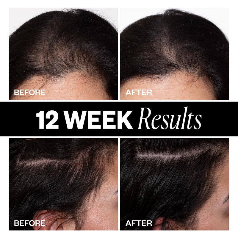 IGK Sponsored - Scalp Treatment for Hair Growth â€“ Hair Thickening Serum for Women â€“ Promotes Fuller, Thicker Hair â€“ Scalp Serum for Hair Density and Thinning - 2.1oz - Image 4