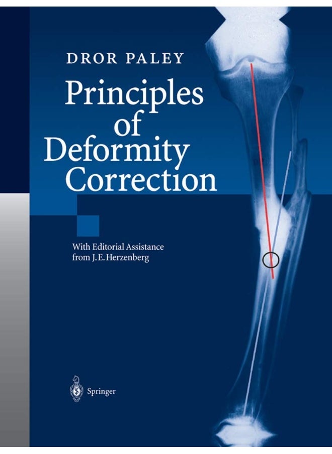 Principles of Deformity Correction 