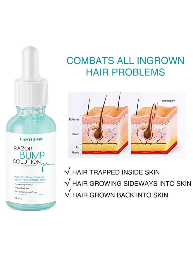 Lanthome Razor Bump Solution,Hair Growth Inhibitor Safe and Gentle Repair serum, Delay Hair Growth, No Black Spots 30ml - Image 5