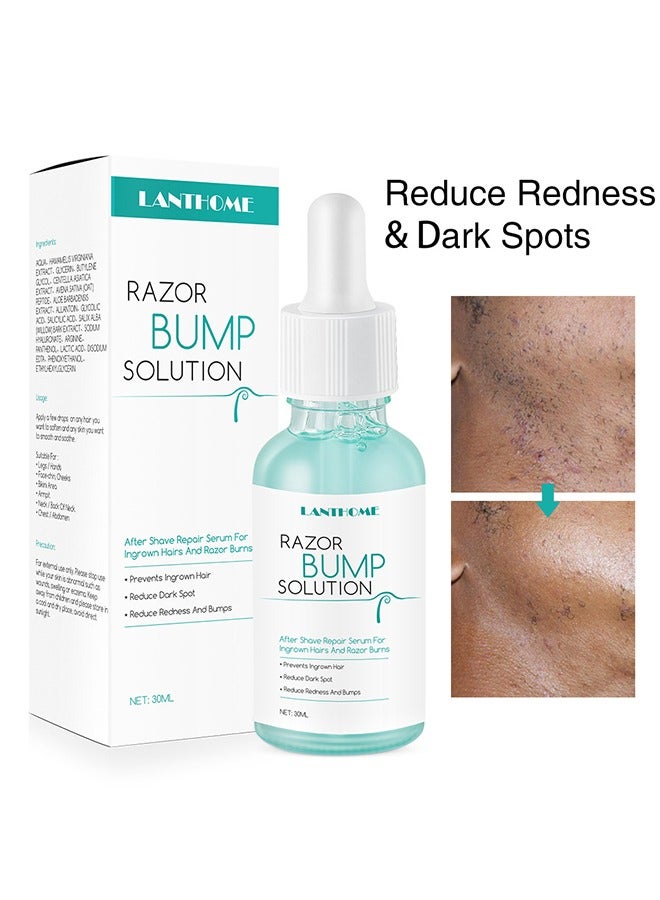 Lanthome Razor Bump Solution,Hair Growth Inhibitor Safe and Gentle Repair serum, Delay Hair Growth, No Black Spots 30ml - Image 1
