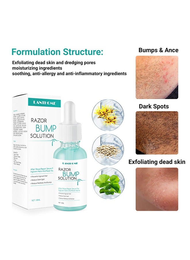 Lanthome Razor Bump Solution,Hair Growth Inhibitor Safe and Gentle Repair serum, Delay Hair Growth, No Black Spots 30ml - Image 3