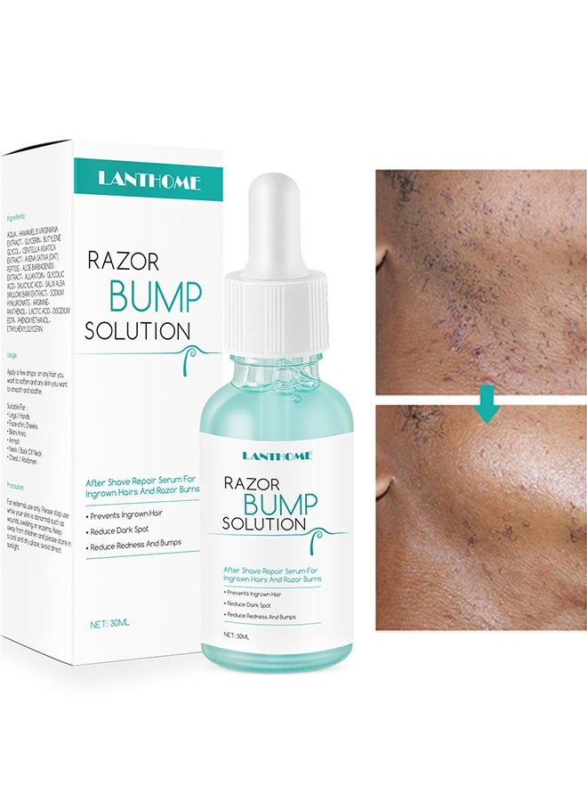 Lanthome Razor Bump Solution,Hair Growth Inhibitor Safe and Gentle Repair serum, Delay Hair Growth, No Black Spots 30ml - Image 1