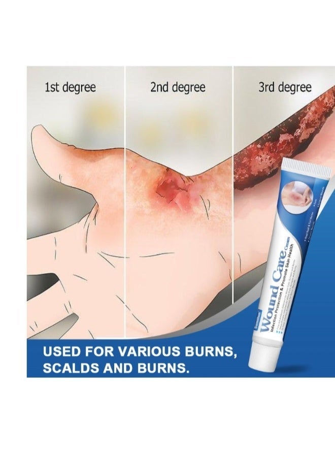 QANZIRE Burn Ointment Burning Wound Care Anti-Infection Cream Antibacterial Skin Healing Burn Ointment 20g - Image 4