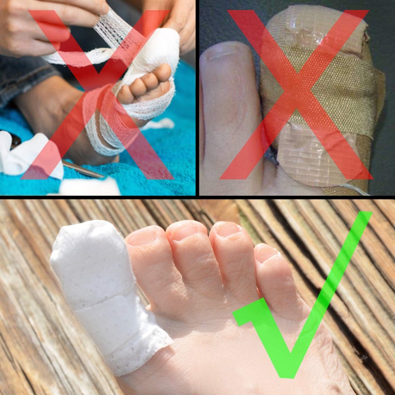 BOUNCEBACK MediMitt ToeMitt Big Toe Bandages Non-Adhesive (Full Coverage Big Toe Bandage) (with Absorbent Pad, Medium (Pack of 10)) - Image 2