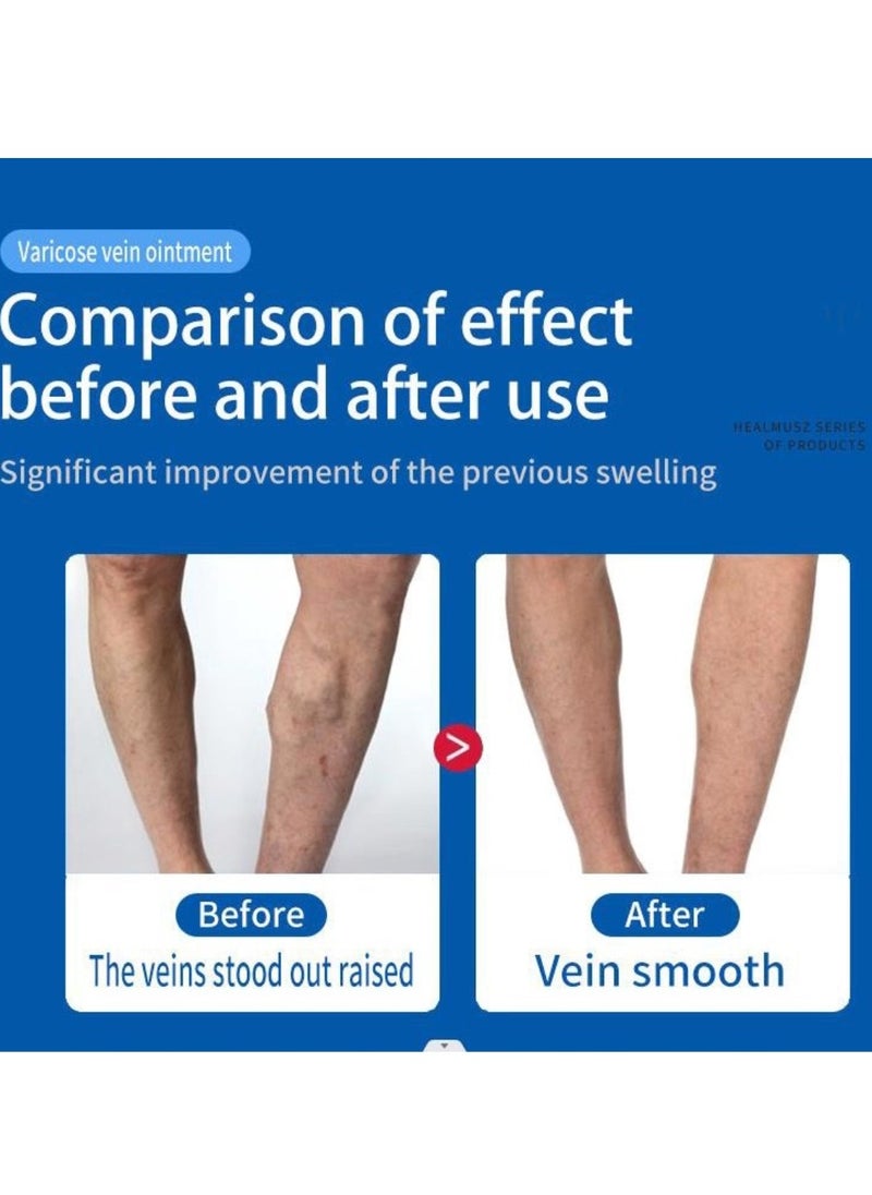 HEALMUSZ - Varicose Vein Cream for Legs Reduces Spider Veins and Heaviness Anti Varicose Vein Soothing Leg Cream to Improve Blood Circulation Enhance Capillary Varicose Vein Repair Cream 20g - Image 1