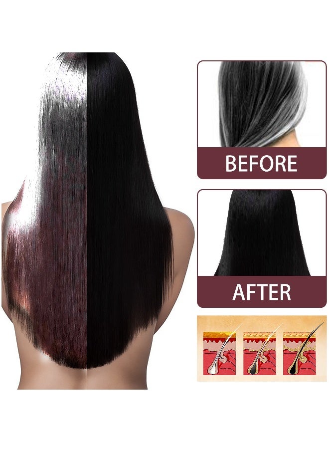 ساوث مون رذاذ إصلاح الشعر العشبي 100 مل، سائل شعر أسود من بوليغونوم مالتيفلوروم والزنجبيل، مستخلصات عشبية تغذي وتصلح الشعر الرمادي - Image 2