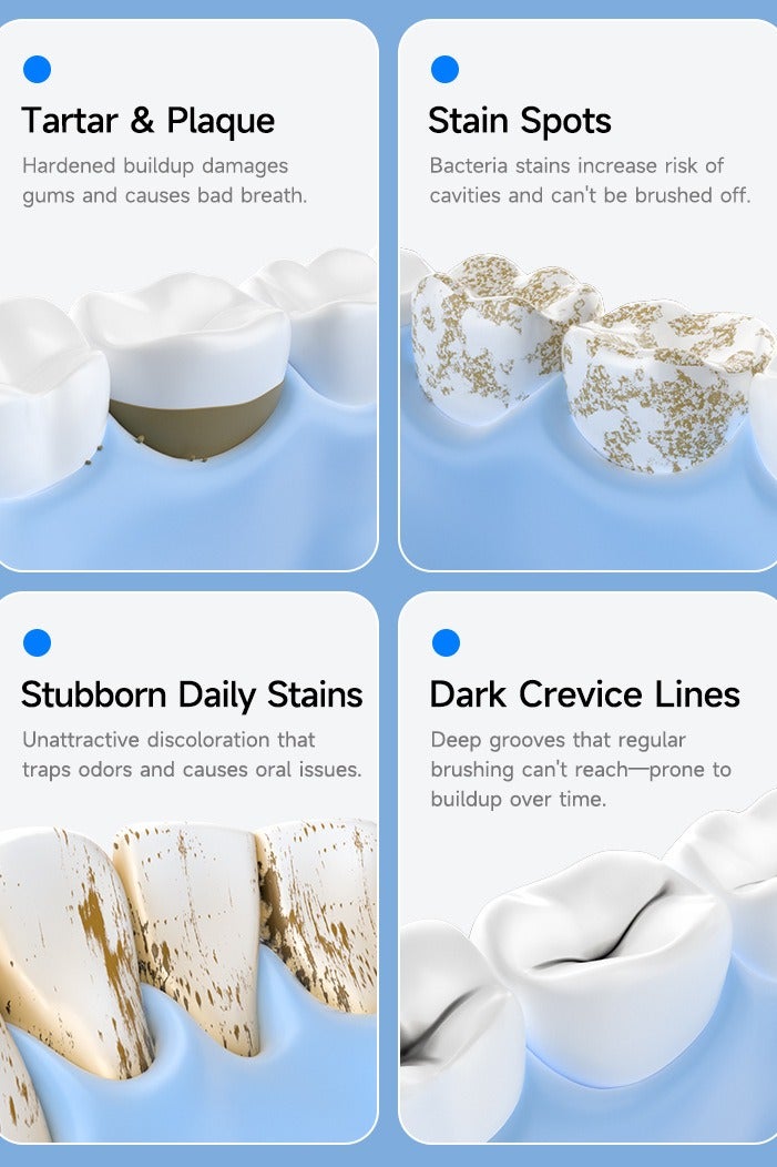 YANCI Ultrasonic Dental Scaler For Teeth Tartar Stain Tooth Calculus Remover Electric Sonic Teeth Plaque Cleaner Dental Stone Removal, Replaceable Clean Heads- Safe - Image 2