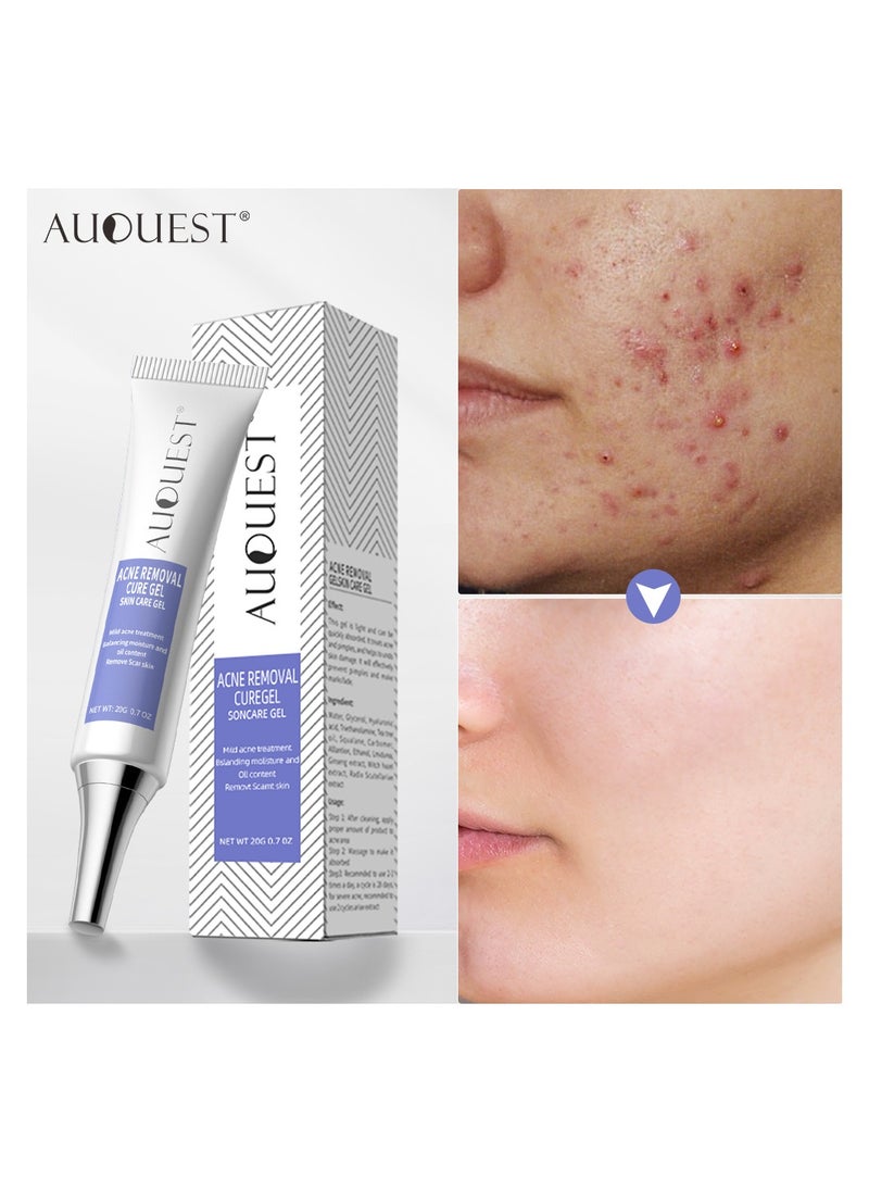 AuQuest - Herbal Acne Treatment Cream Pimple Spot Removal for Teens Oil Control Acne Scar Gel Shrink Pores Skin Care Beauty Health - Image 1