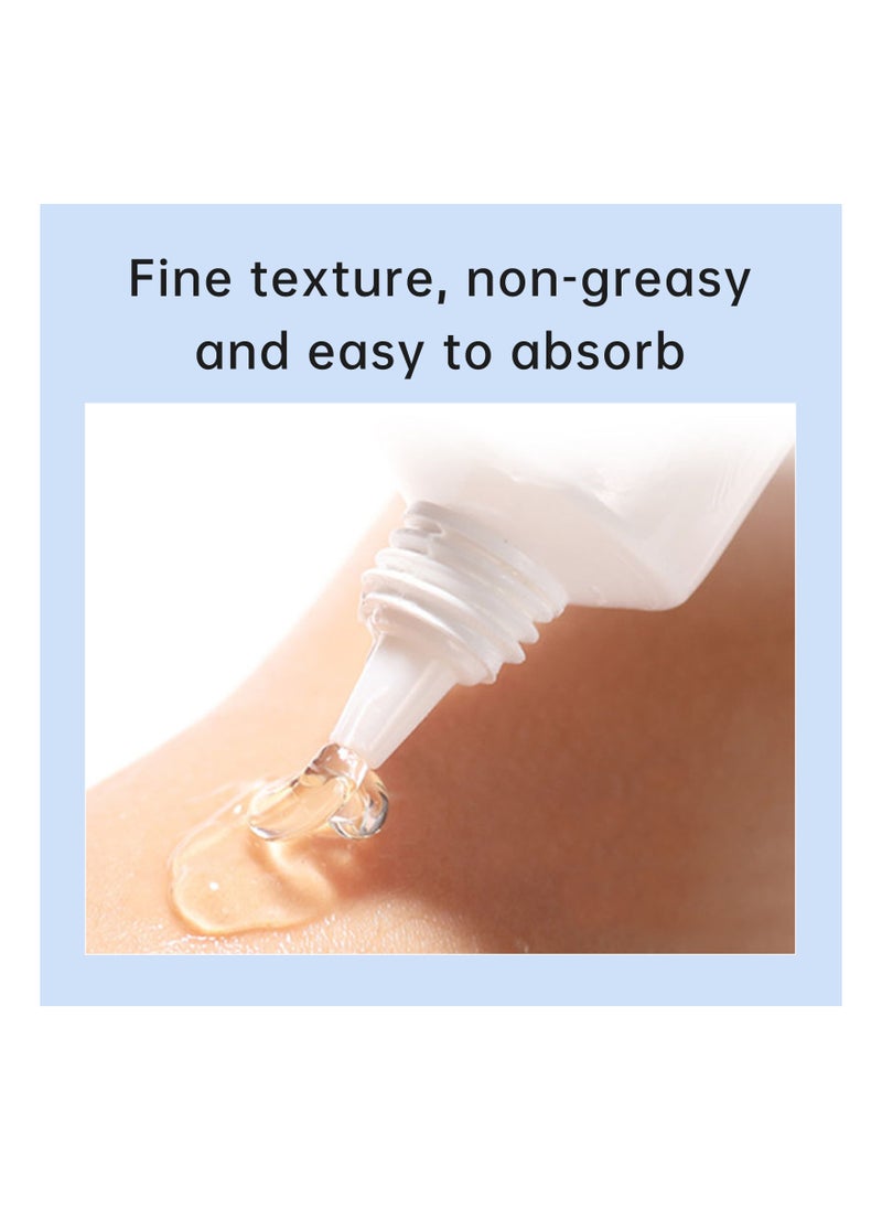 AuQuest - Herbal Acne Treatment Cream Pimple Spot Removal for Teens Oil Control Acne Scar Gel Shrink Pores Skin Care Beauty Health - Image 1