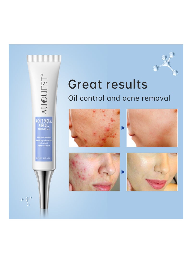 AuQuest - Herbal Acne Treatment Cream Pimple Spot Removal for Teens Oil Control Acne Scar Gel Shrink Pores Skin Care Beauty Health - Image 1