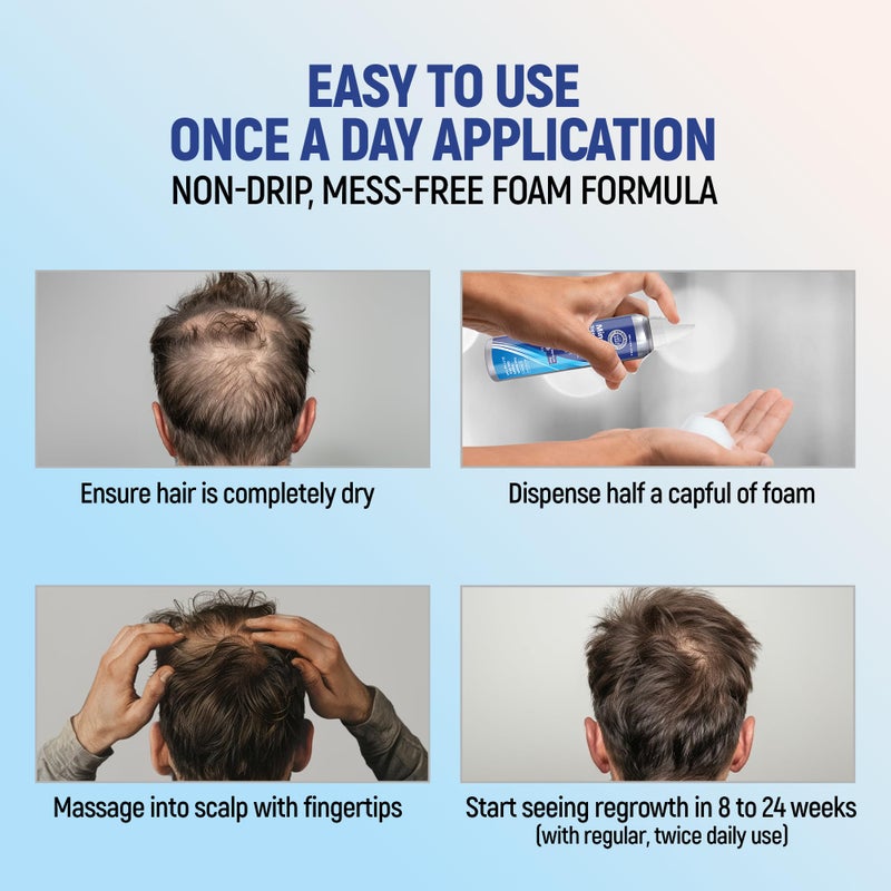 Taro Minoxidil Topical Aerosol Foam, 5%, Hair Regrowth 4 Months Treatment for Men, 2.11 oz (4 Pack) - Image 4