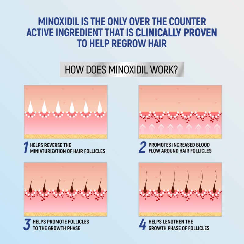 Taro Minoxidil Topical Aerosol Foam, 5%, Hair Regrowth 4 Months Treatment for Men, 2.11 oz (4 Pack) - Image 5