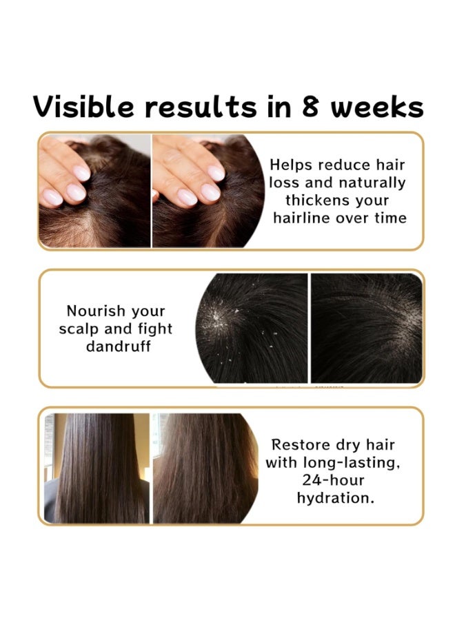 1 PCS Anti Hair Loss Shampoo, Promote Hair Growth and Thickening & Strengthening Shampoo with Various Plant Extracts for Thinning Hair Women（300ml） - Image 3