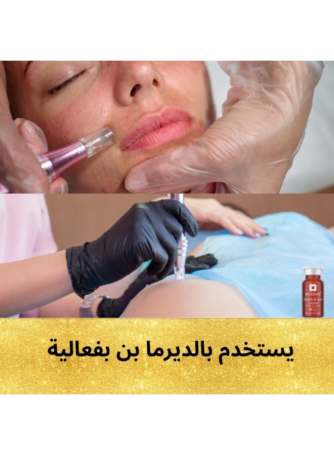 MESOBASE Stretch & Scar Cocktail MesoBase Brand Spanish for Scars  Acne Scars Acnes Spots InjuriesBurns Stretch Marks, Scratches  Maternity Repair (1 pack 10 ml) - Image 2