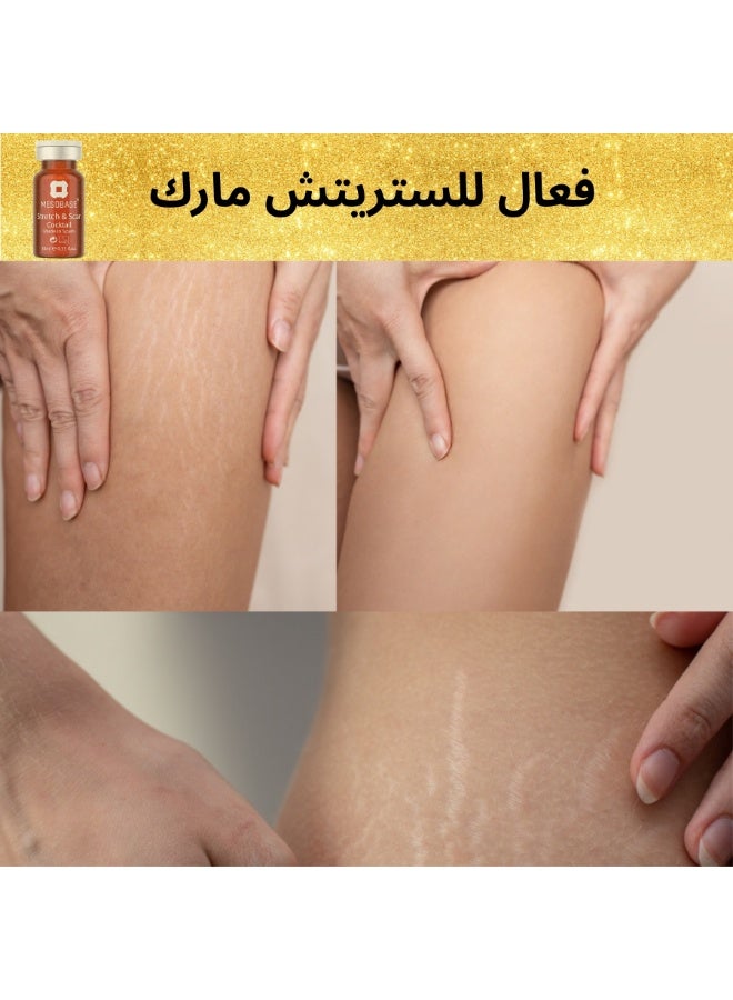 MESOBASE Stretch & Scar Cocktail MesoBase Brand Spanish for Scars  Acne Scars Acnes Spots InjuriesBurns Stretch Marks, Scratches  Maternity Repair (1 pack 10 ml) - Image 3