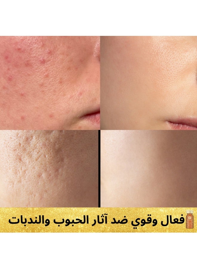 MESOBASE Stretch & Scar Cocktail MesoBase Brand Spanish for Scars  Acne Scars Acnes Spots InjuriesBurns Stretch Marks, Scratches  Maternity Repair (1 pack 10 ml) - Image 4