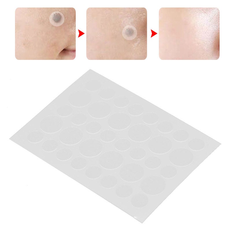 Skin Tag Patch: 36pcs Hydrocolloid Patches (24 Small 12 Large) Multi-Site Applicable - Gentle Concealing & Covering Skin Tag Cover for Body Face Acne Pimple Care - Image 1