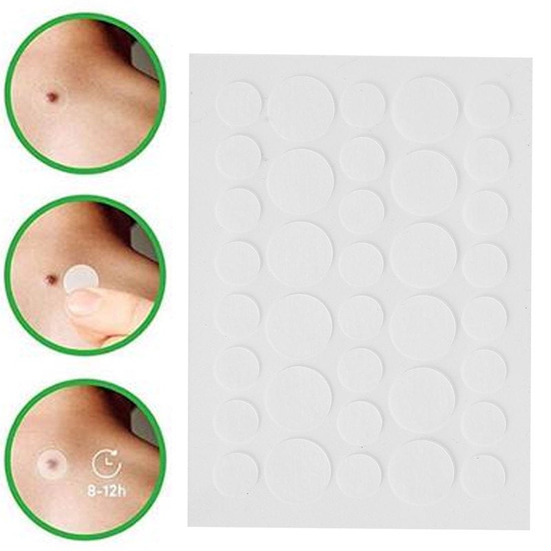 Skin Tag Patch: 36pcs Hydrocolloid Patches (24 Small 12 Large) Multi-Site Applicable - Gentle Concealing & Covering Skin Tag Cover for Body Face Acne Pimple Care - Image 5